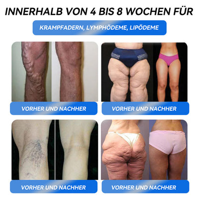 GLP-1 Schlankheits-Trinklösung – Klinisch getestet & hormonfrei