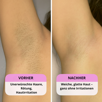 SilkGleam™ | 2-in-1 Trimmer für Gesicht & Körper – Sanft, Wasserdicht & Wiederaufladbar