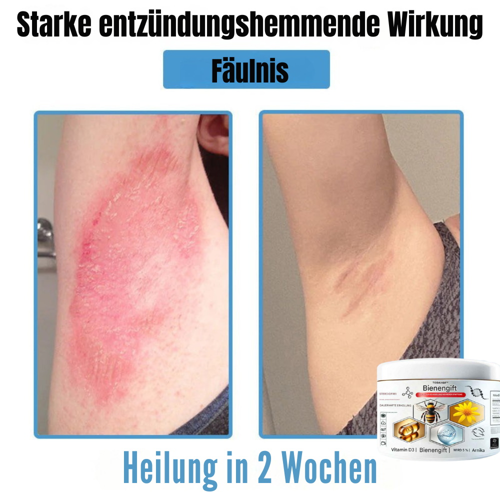 BIENENGIFT® – Multi-Symptom Creme gegen Hautprobleme