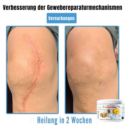 BIENENGIFT® – Multi-Symptom Creme gegen Hautprobleme