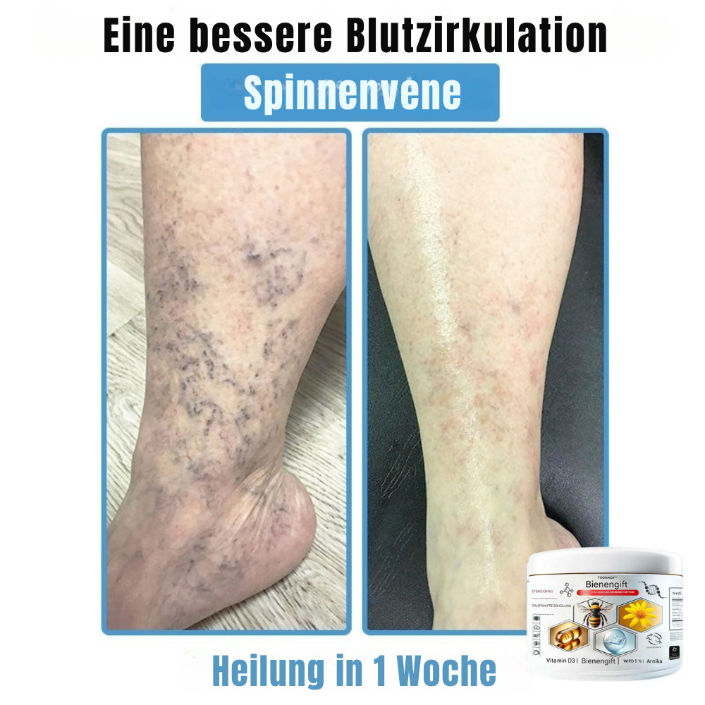 BIENENGIFT® – Multi-Symptom Creme gegen Hautprobleme