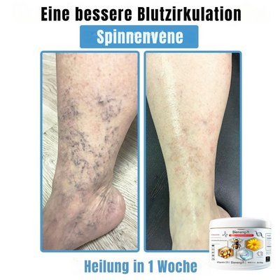 BIENENGIFT® – Multi-Symptom Creme gegen Hautprobleme