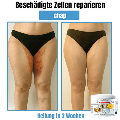 BIENENGIFT® – Multi-Symptom Creme gegen Hautprobleme
