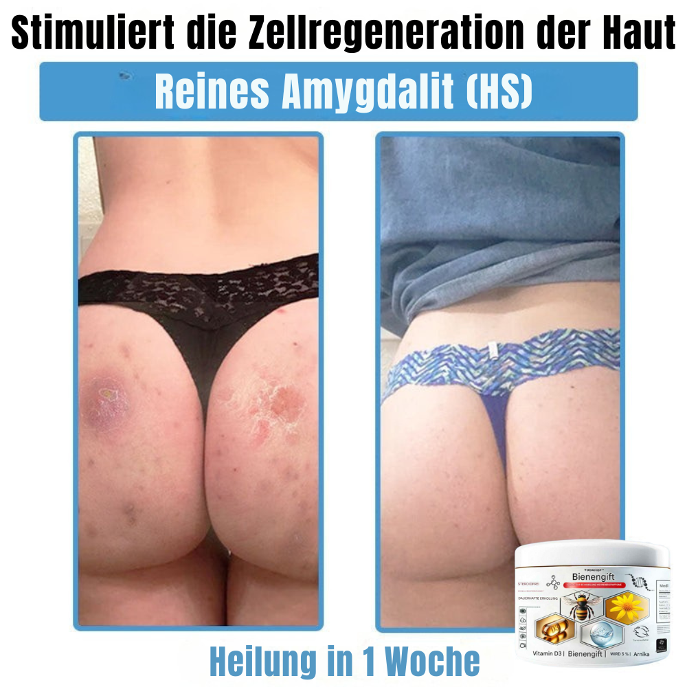 BIENENGIFT® – Multi-Symptom Creme gegen Hautprobleme