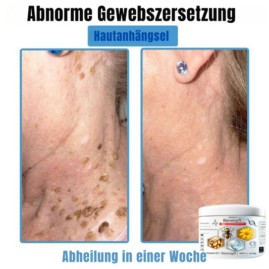 BIENENGIFT® – Multi-Symptom Creme gegen Hautprobleme