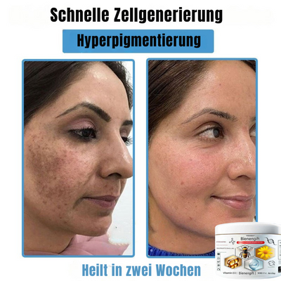 BIENENGIFT® – Multi-Symptom Creme gegen Hautprobleme